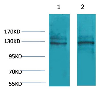 Calcium Sensing Receptor Rabbit pAb Antibody