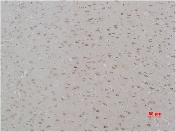 Calcium Sensing Receptor Rabbit pAb Antibody