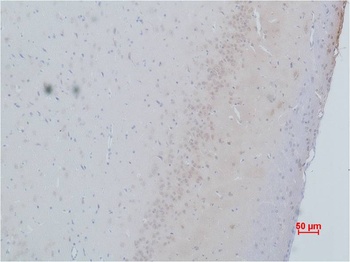 Cav γ2 Rabbit pAb Antibody