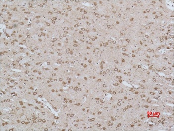 Cav γ3 Rabbit pAb Antibody