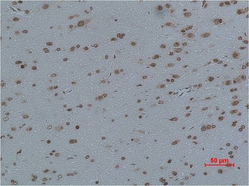 Cav γ4 Rabbit pAb Antibody