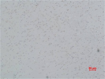 Cav γ5 Rabbit pAb Antibody