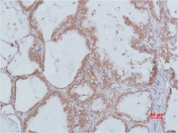 STAT2 Rabbit pAb Antibody