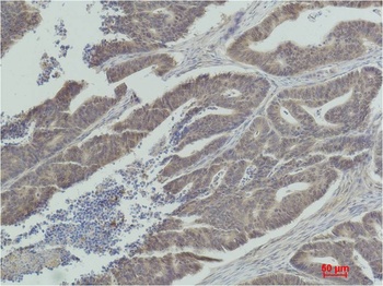 MEK1 Rabbit pAb Antibody