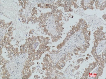 MEK2 Rabbit pAb Antibody