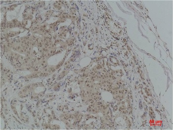 TGFβ1 Rabbit pAb Antibody