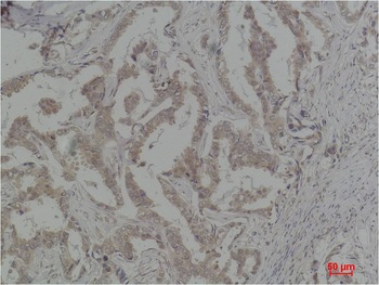 Caspase 8 Rabbit pAb Antibody
