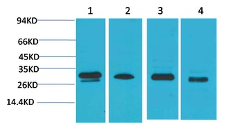 AMPKβ2 Rabbit pAb Antibody