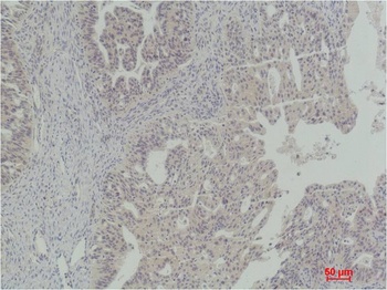 STAT5a Rabbit pAb Antibody