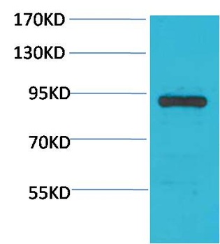 STAT4 Rabbit pAb Antibody