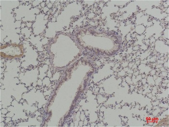 Cyclin D1 Rabbit pAb Antibody