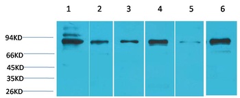 STAT5b Rabbit pAb Antibody