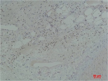 STAT5b Rabbit pAb Antibody