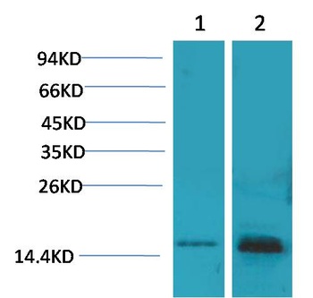 S100 Rabbit pAb Antibody