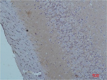 S100 Rabbit pAb Antibody