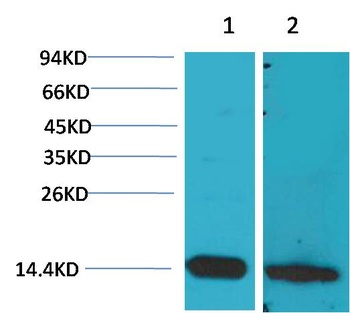 S100 β Rabbit pAb Antibody
