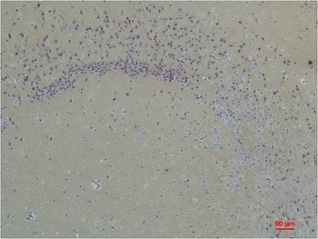 Glutamate Receptor 1 Rabbit pAb Antibody