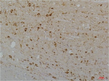 Cav1.3 Rabbit pAb Antibody