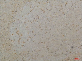 Cav1.3 Rabbit pAb Antibody