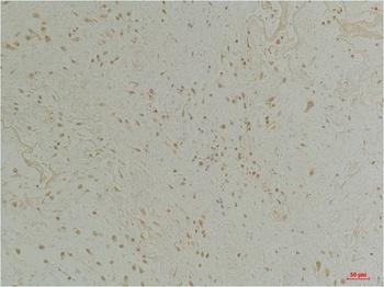 CLIC1 Rabbit pAb Antibody