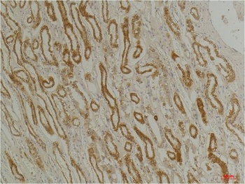 CLIC1 Rabbit pAb Antibody
