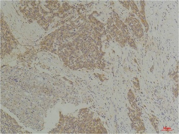 CLIC4 Rabbit pAb Antibody