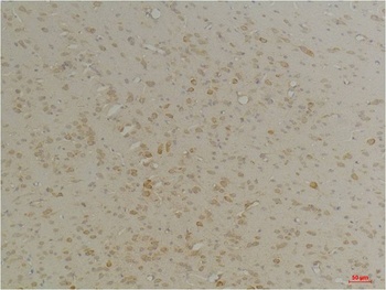 CLIC4 Rabbit pAb Antibody