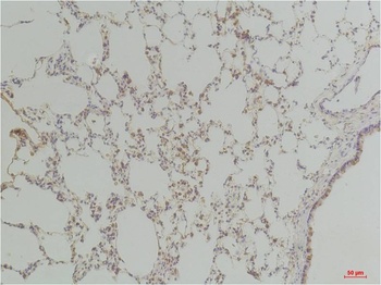 Endothelin B Receptor Rabbit pAb Antibody