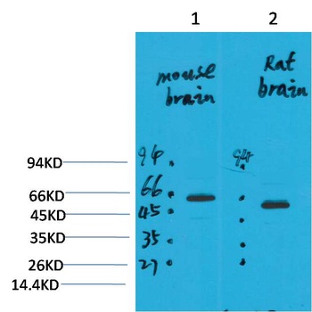 EAAT2 Rabbit pAb Antibody