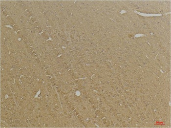 GABA B Receptor 2 Rabbit pAb Antibody