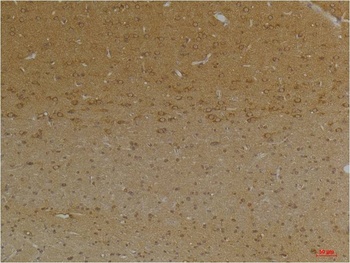 KCNK9(TASK-3) Rabbit pAb Antibody