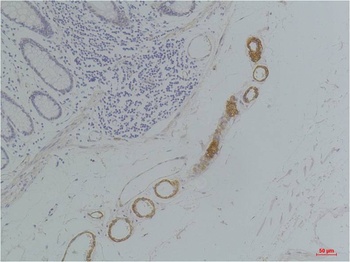 GRIK2(GluR6) Rabbit pAb Antibody