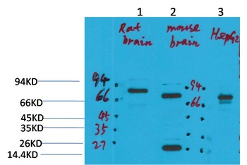 KCNN2(SK2) Rabbit pAb Antibody