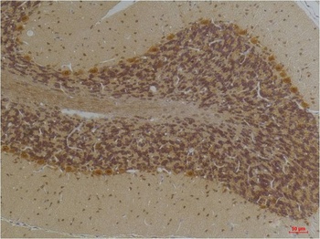 KCNN2(SK2) Rabbit pAb Antibody