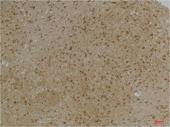 KCNN2(SK2) Rabbit pAb Antibody