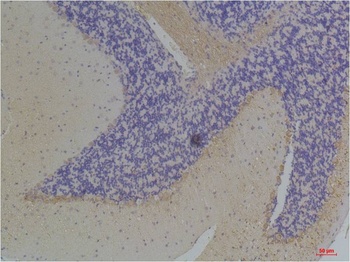 KChIP3 Rabbit pAb Antibody