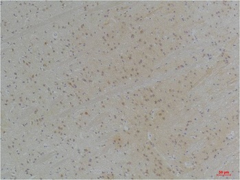 KVβ1 Rabbit pAb Antibody