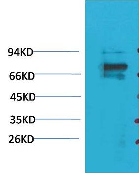 Kv1.5 Rabbit pAb Antibody