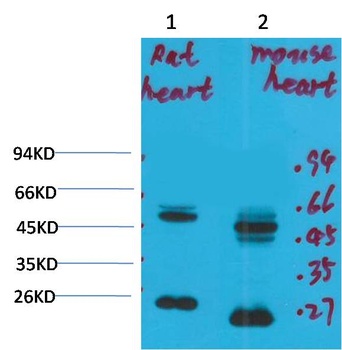 Kv1.8 Rabbit pAb Antibody