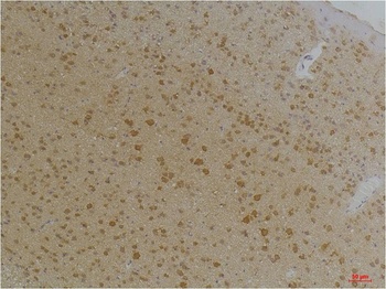Kv1.8 Rabbit pAb Antibody