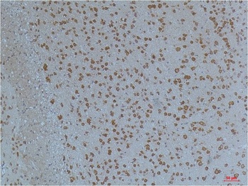 Kv11.1 Rabbit pAb Antibody