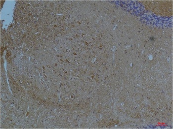 Kv11.3 Rabbit pAb Antibody
