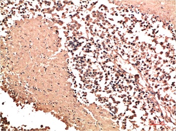 NM23A Rabbit pAb Antibody