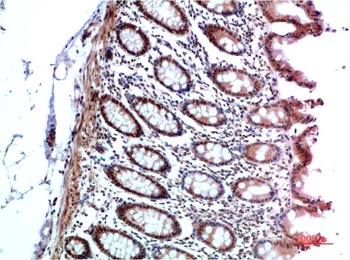 HP-1 α Rabbit pAb Antibody