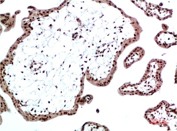 HP-1 α Rabbit pAb Antibody