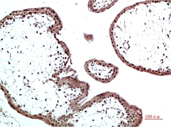 HP-1 β/CBX1 Rabbit pAb Antibody