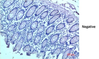 HP-1 β/CBX1 Rabbit pAb Antibody