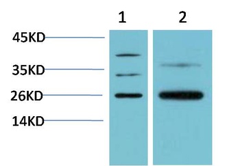HP-1 β/CBX1 Rabbit pAb Antibody