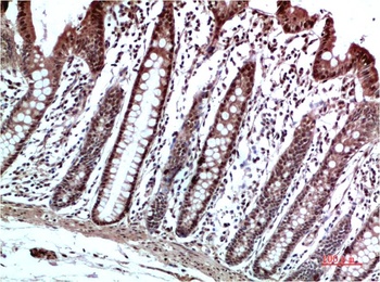 HP-1 γ Rabbit pAb Antibody