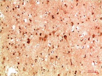 HSP40 Rabbit pAb Antibody